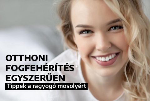 Otthoni fogfehérítés egyszerűen – tippek a ragyogó mosolyért